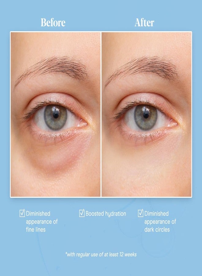 بيبادي كريم العين بايبودي بخلاصة مخاط الحلزون (30 مل/1.06 أونصة سائلة) - كريم مضاد لعلامات تقدم السن للهالات السوداء والبشرة الجافة - سيروم مخاط الحلزون مع الببتيدات وحمض الهيالورونيك - Image 5